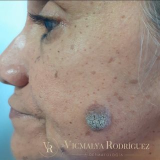 Dra.-Vicmalya-Rodriguez-3